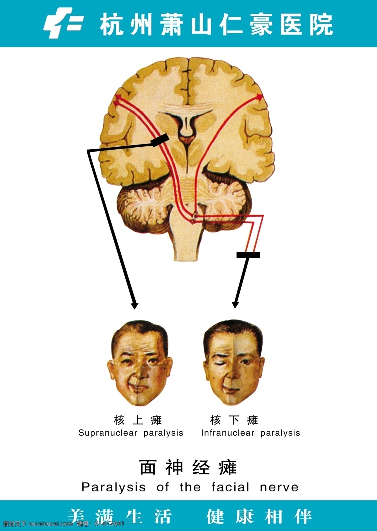 醫(yī)療 人體 科室 掛圖 分層 psd源文件 骨架 器官 人體器官圖 醫(yī)院 醫(yī)院醫(yī)療 人體科室掛圖 面神經(jīng)癱 結(jié)構(gòu)圖 圖