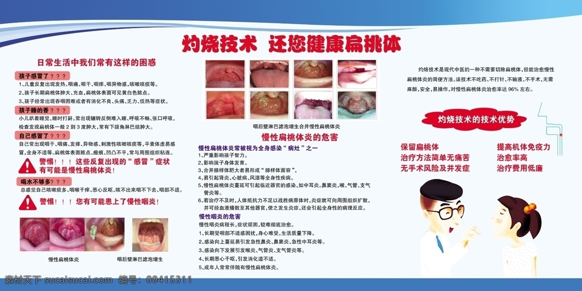 灼烧技术 还 健康 扁桃体 健康扁桃体 慢性扁桃体炎 慢性咽炎 灼烧技术优势 灼烙技术 分层