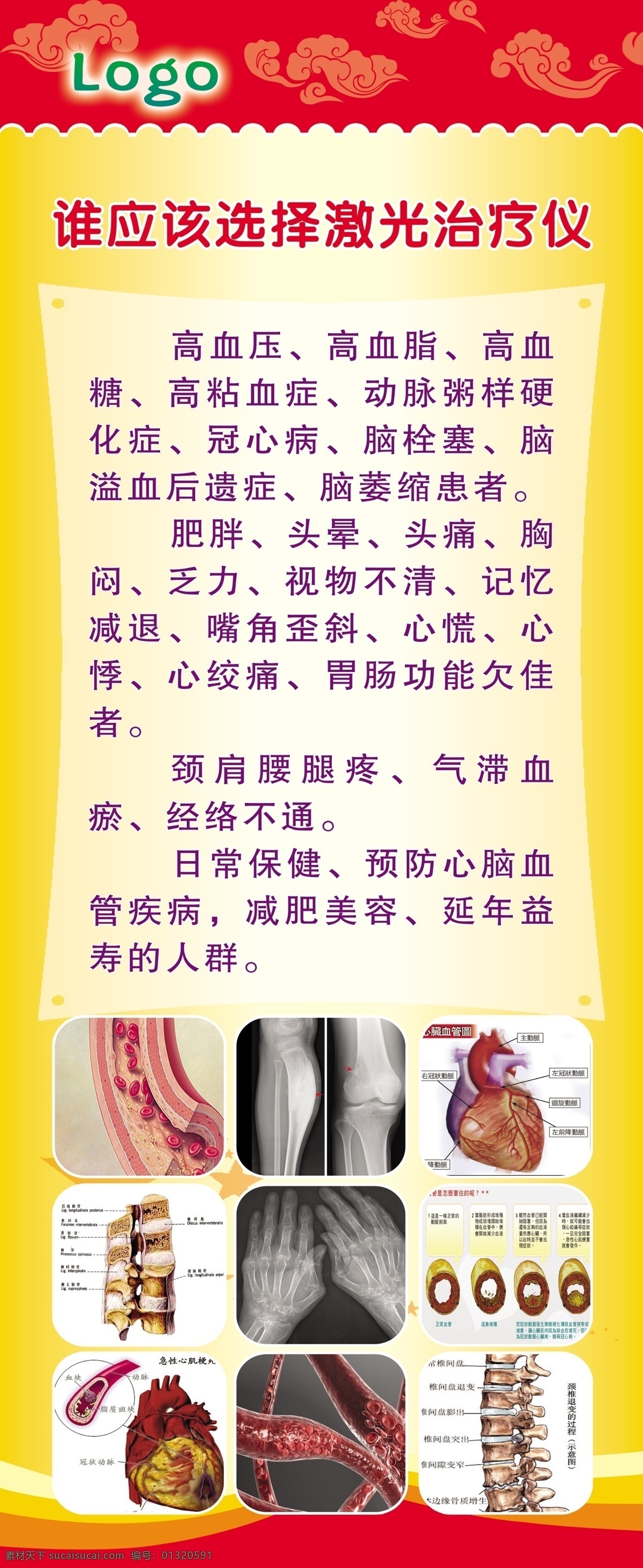 广告设计模板 疾病 医院宣传海报 源文件 医院 宣传海报 模板下载 应该 选择 激光 治疗仪 激光治疗仪 疾病图