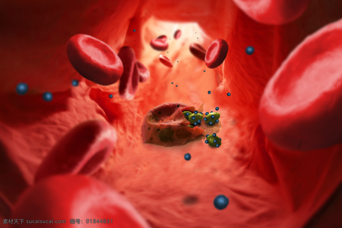 动脉 血红细胞 血管 病源 病变 3d 医学研究 血液 科学 显微状态 现代科技 医疗护理