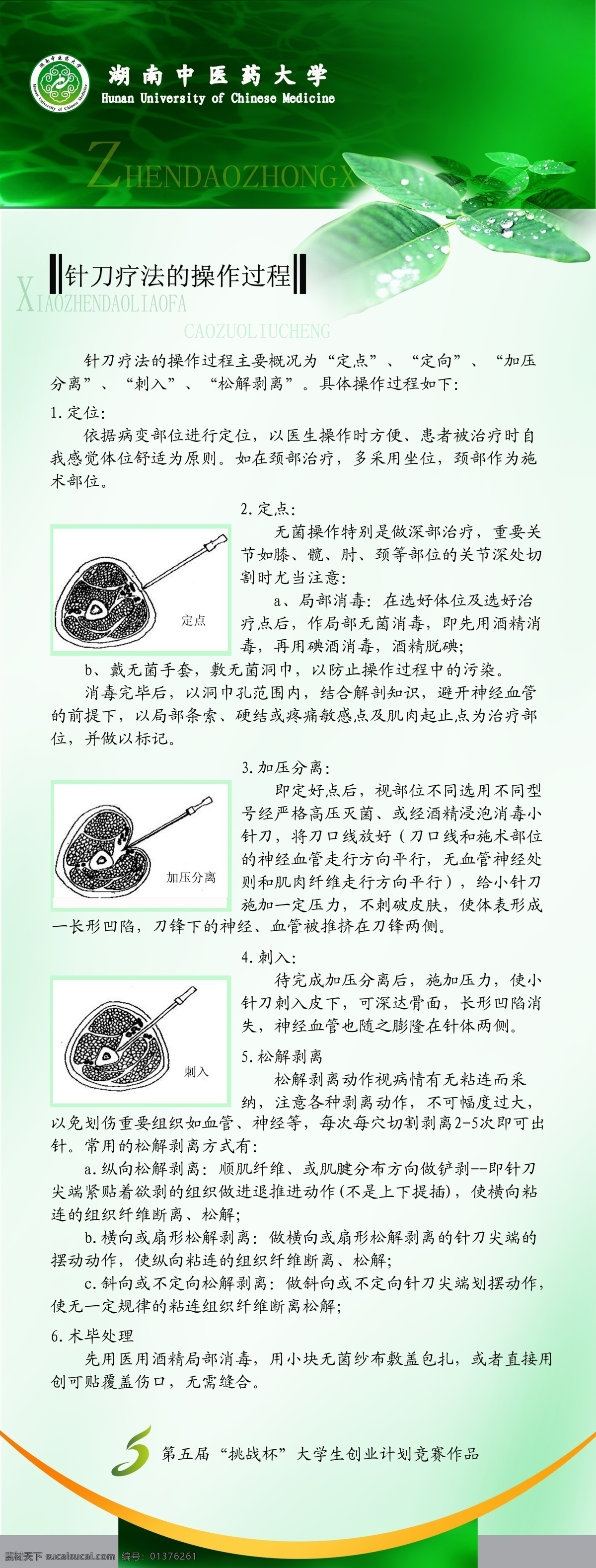 psd分层图 x展架 广告设计模板 源文件 展板模板 中医 小 针刀 x 展架 模板下载 小针刀 海报 其他海报设计