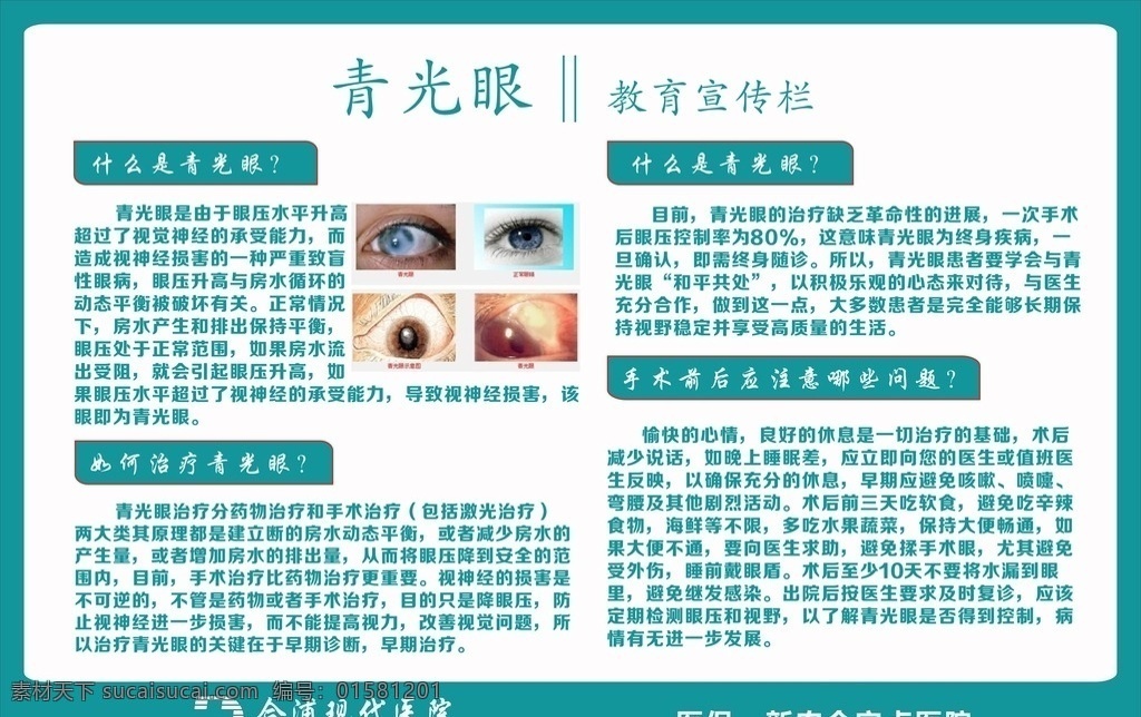 医院 宣传 青光眼 眼科疾病 宣传模版 企业文化宣传 花边 计生 发展 分层 源文件 展板模板