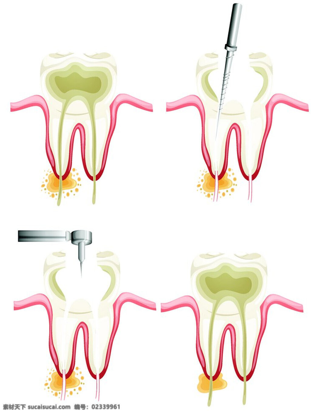医疗 牙齿 图案 医疗牙齿 医疗图案 口腔 牙齿分析 矢量 手术刀