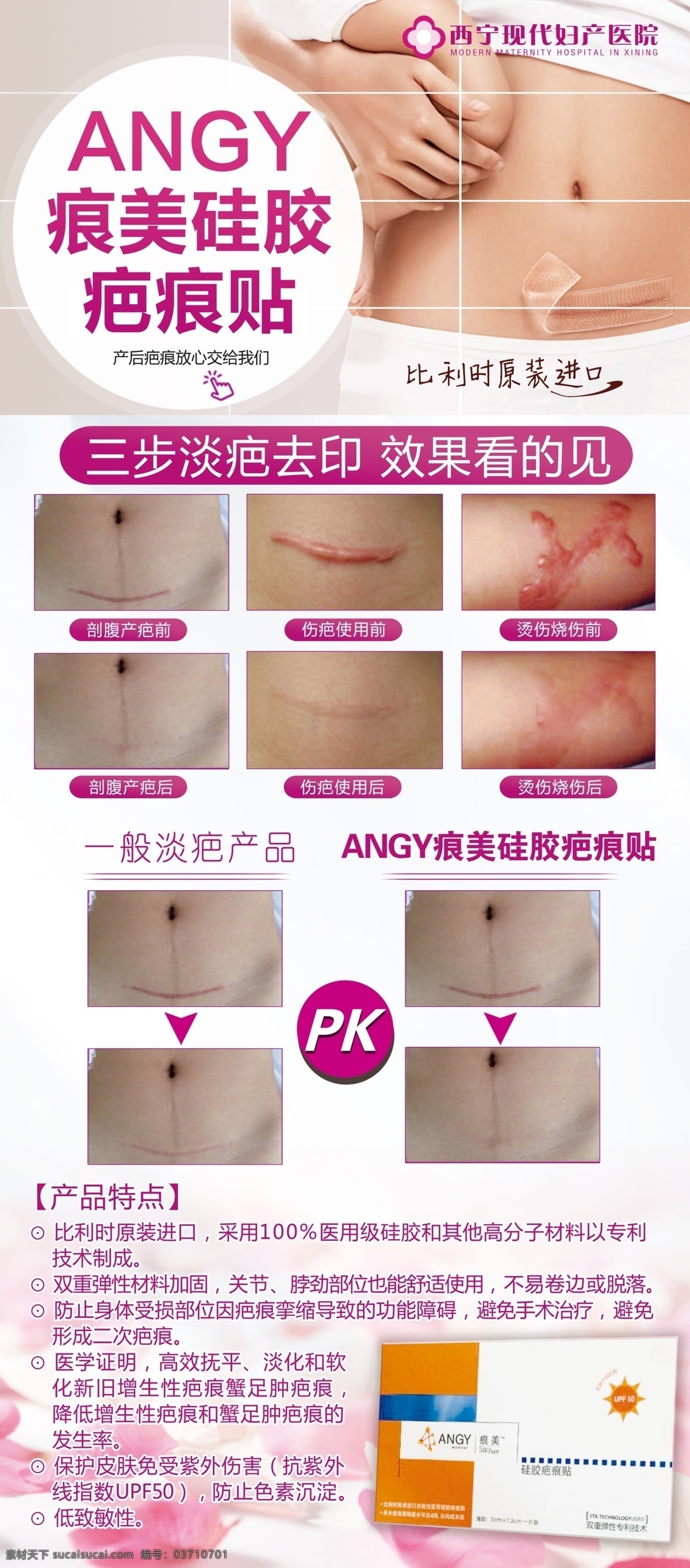 angy 痕 美 硅胶 疤痕 贴 展架 疤痕贴 痕美