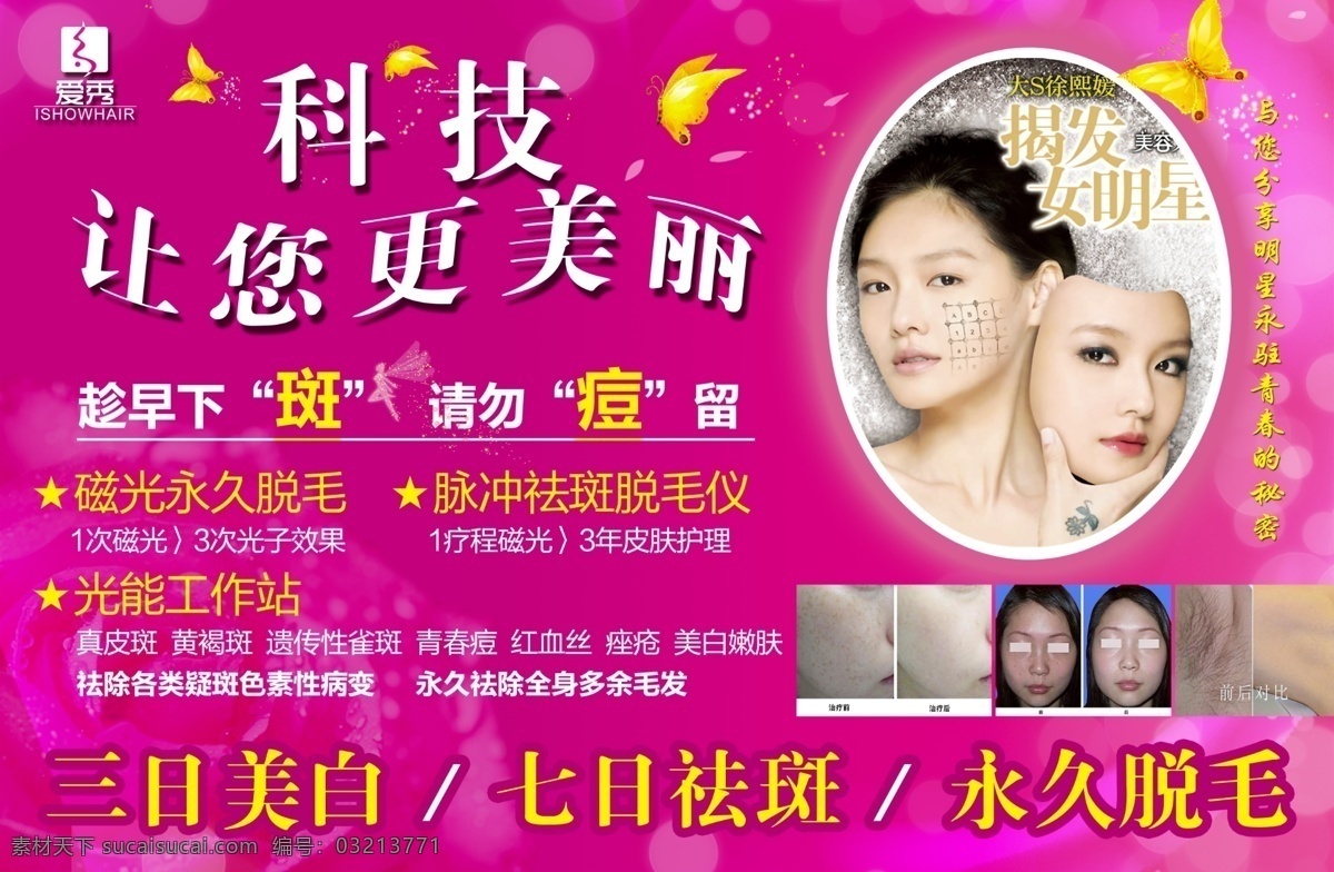 美容展板 美容海报 美容宣传 大s 美容 科技 更 美丽 永久脱毛 三日美白 七日袪斑 趁早下斑 请勿痘留 蝴蝶 飞人 玫瑰花 星光 美容前后对比 美白嫩肤 美容院 展板模板 广告设计模板 源文件