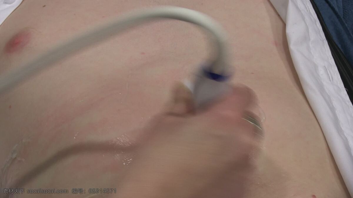 超声扫描1 医学的 医院 超声 医学 屏幕 读出 医生 扫描 筛选 测试 设备 装置 科学 生物学 频率 病人 人体躯干 凝胶 操作 护士