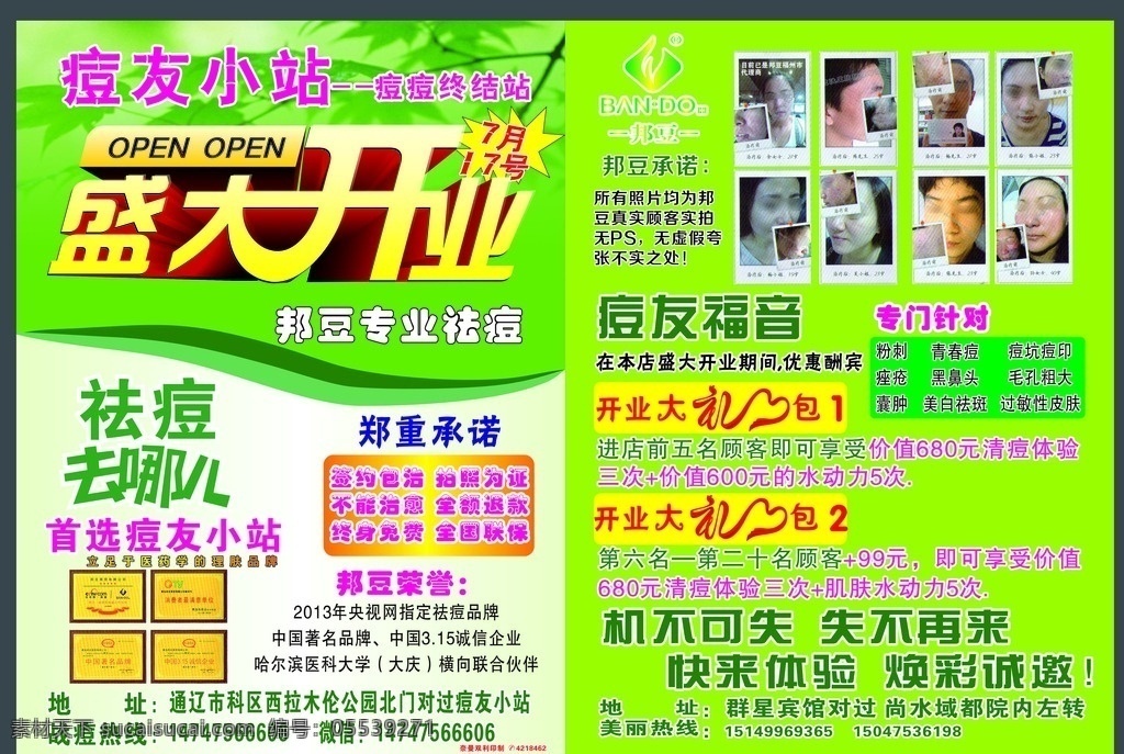 邦痘 青春痘 祛痘痕 祛斑 祛痘 宣传单 dm宣传单
