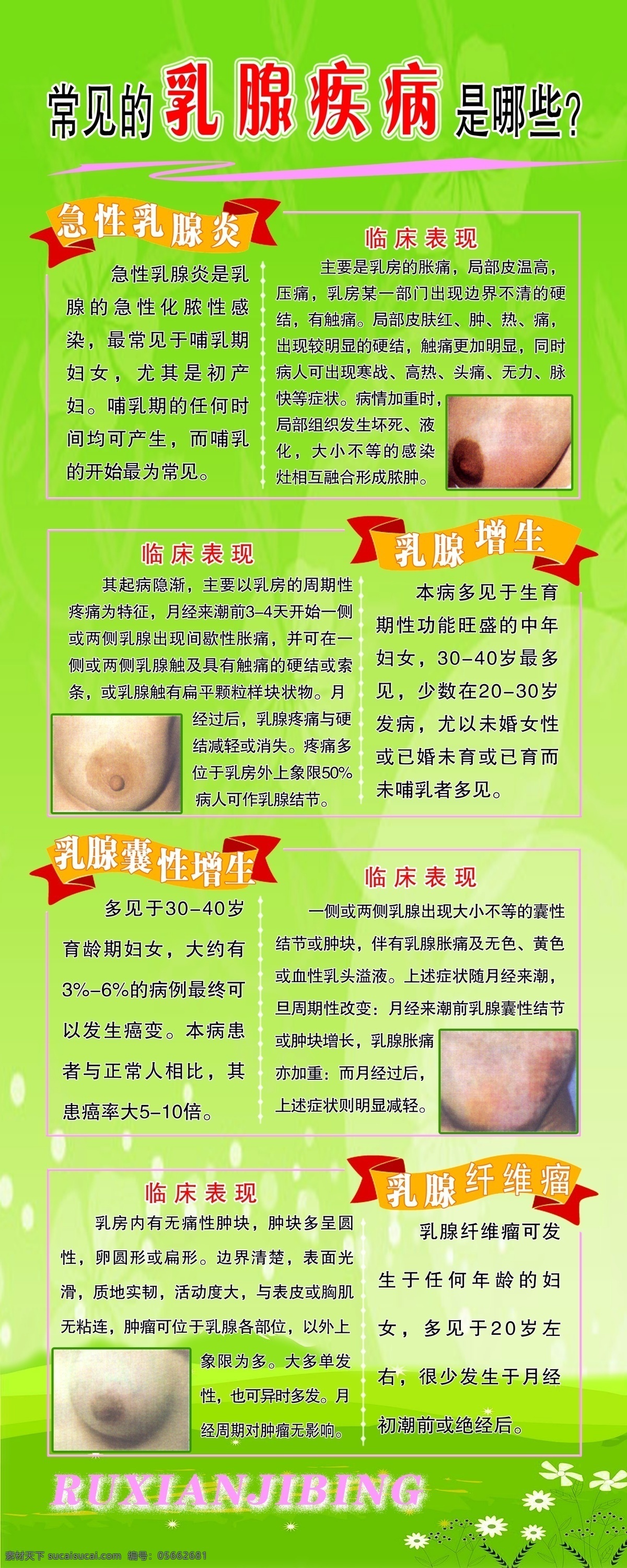 常见 乳腺 疾病 哪些 乳腺疾病 乳房 绿色背景 制度 分层 源文件