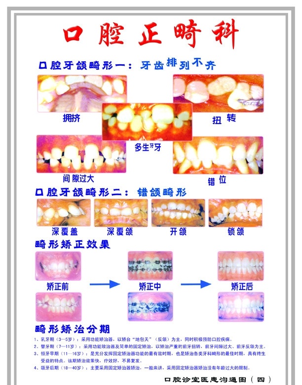 口腔正畸科 口腔 牙齿 牙颌畸形 畸形矫正 畸形矫治 设计源文件 分层 源文件