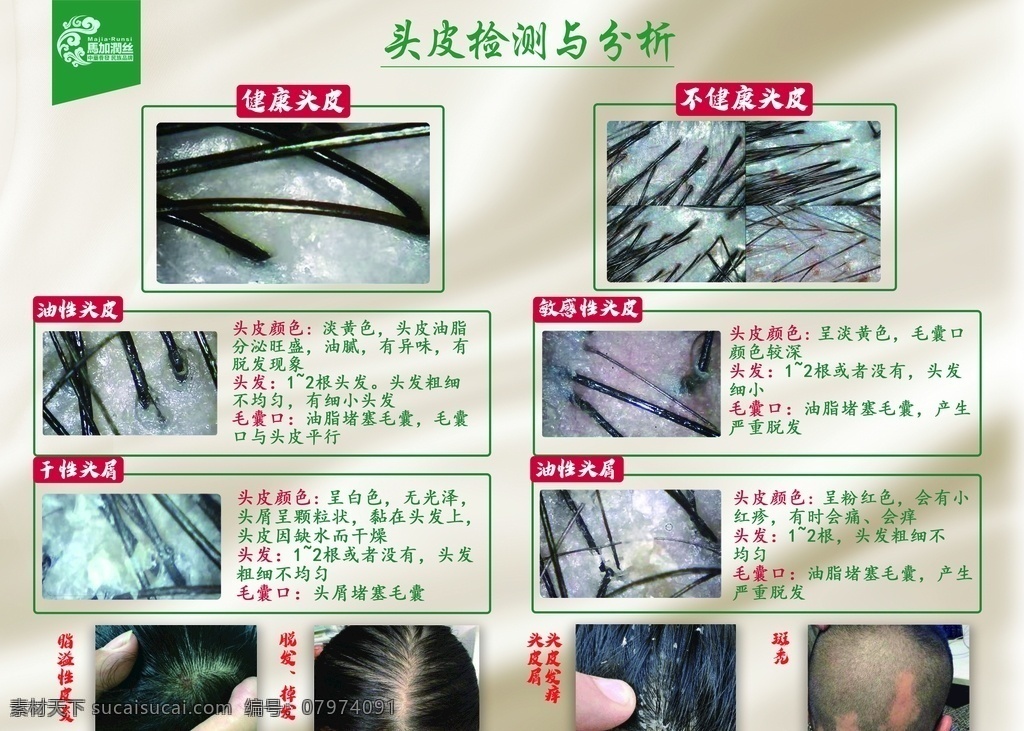 头皮检测图片 头皮 分析 护发 养发 马加润丝 展板模板