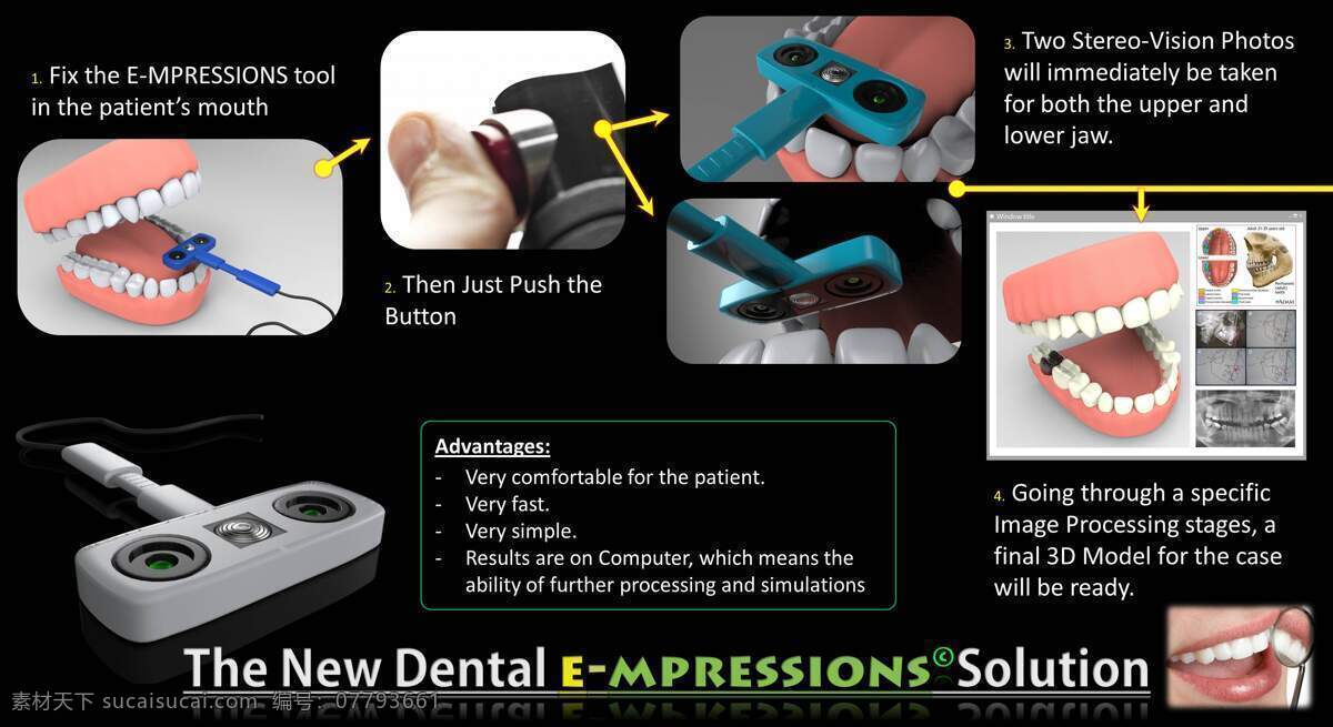 牙科 empressions 工具 creaform 3d模型素材 其他3d模型