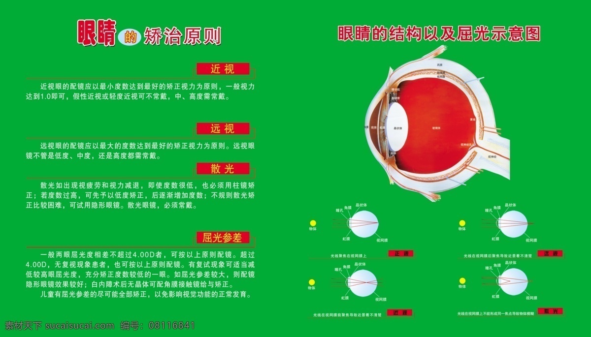 眼睛 矫治 原则 矫治眼睛 眼睛结构 眼睛屈光 眼睛示意图 分层 源文件