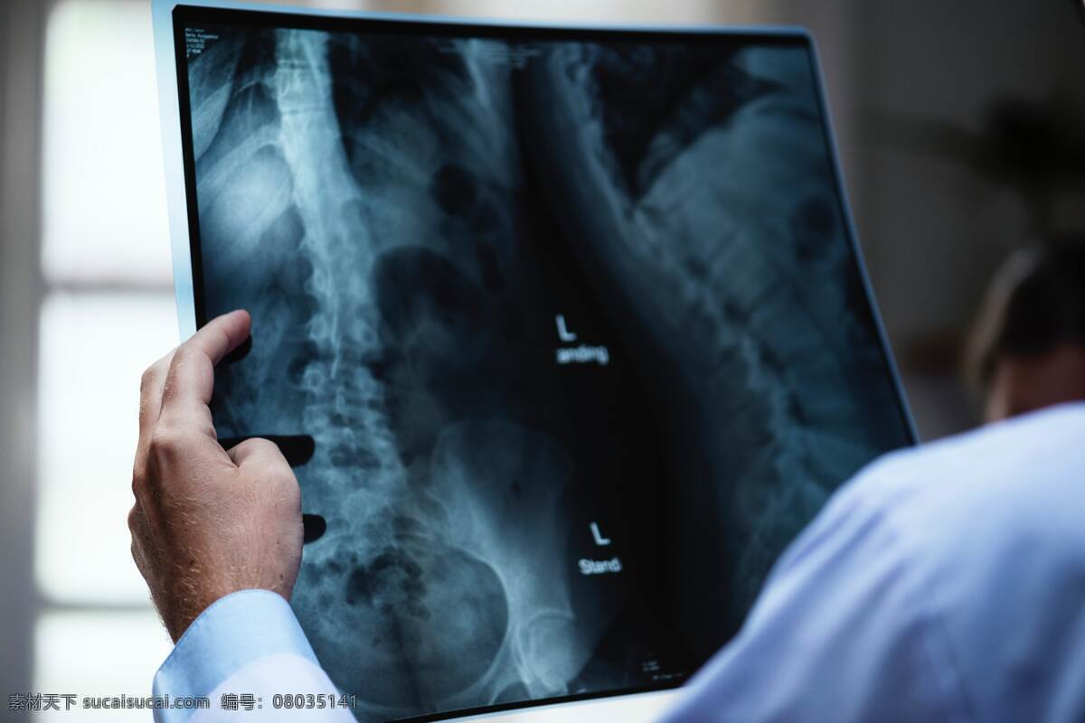 x光片 x光 光片 透视 看片 医生 医疗 室内 背影 脊柱 胸科 外科 特写 现代科技 医疗护理