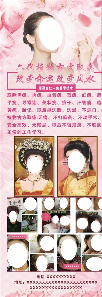 红色 祛痘 祛 痣 美容 展架 易拉宝 海报 祛痣 粉色 女人 效果图 对比图 点痣 展板模板