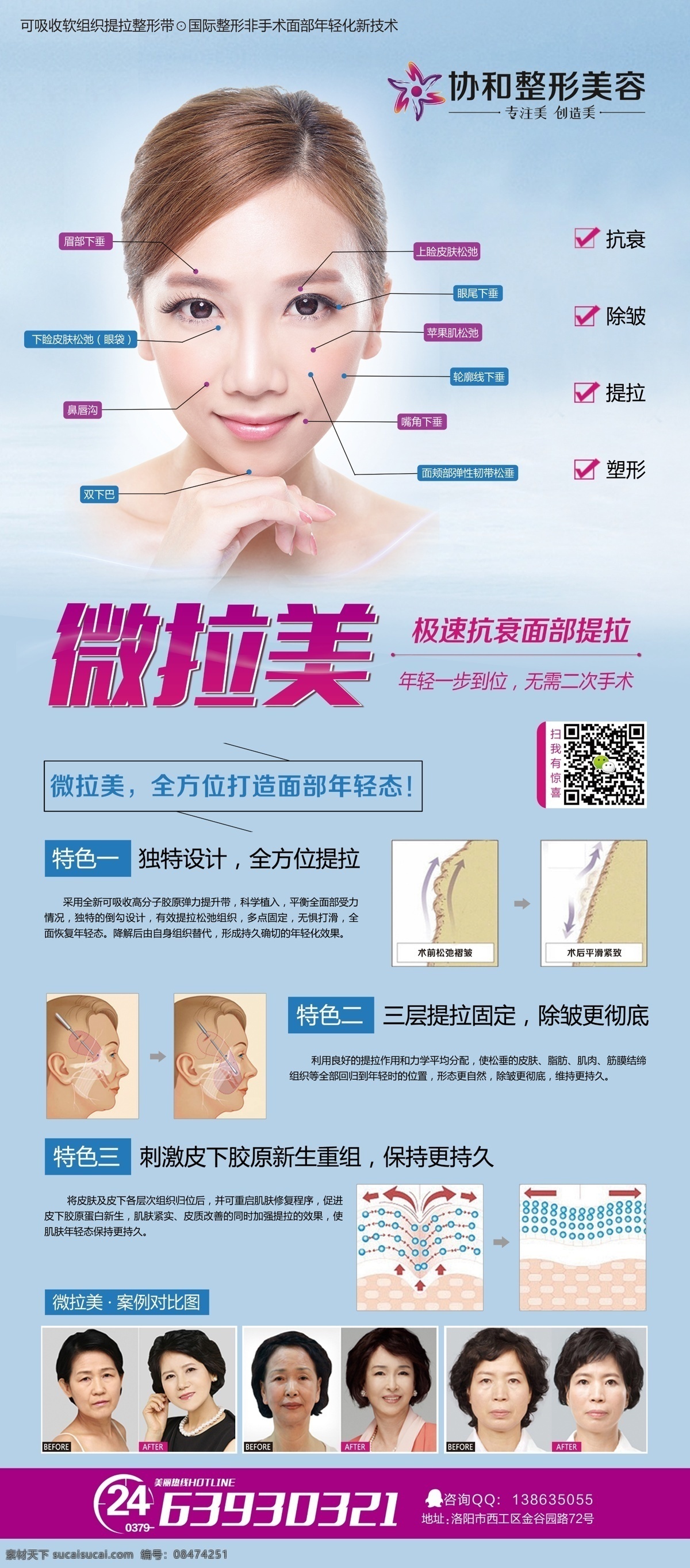 微拉美展架 整形美容 微拉美 整形 美容 美女 广告 展架 项目 整形项目 整容项目
