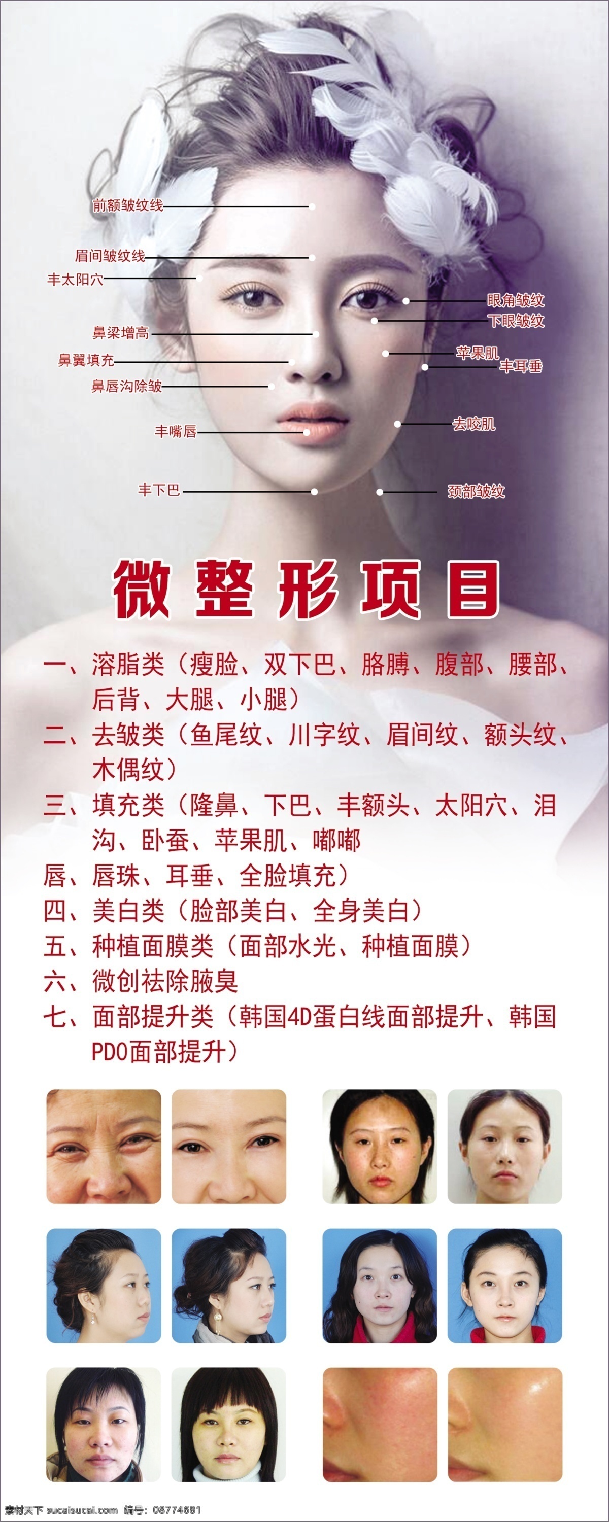 微整形 美容 整形项目 整容 整容项目