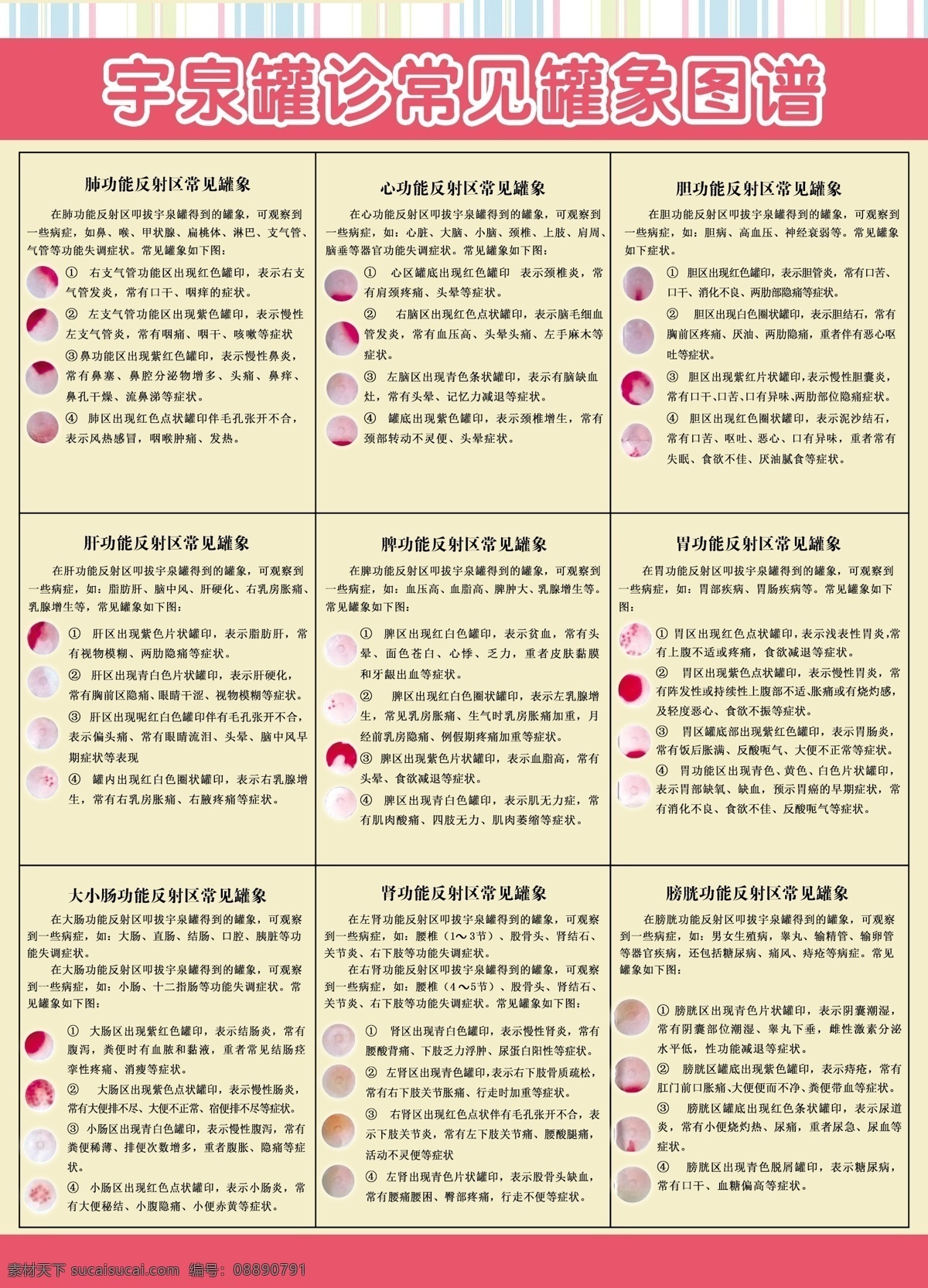 拔罐罐象介绍 拔罐 罐象 宇泉 拔罐的作用 疗效 分层