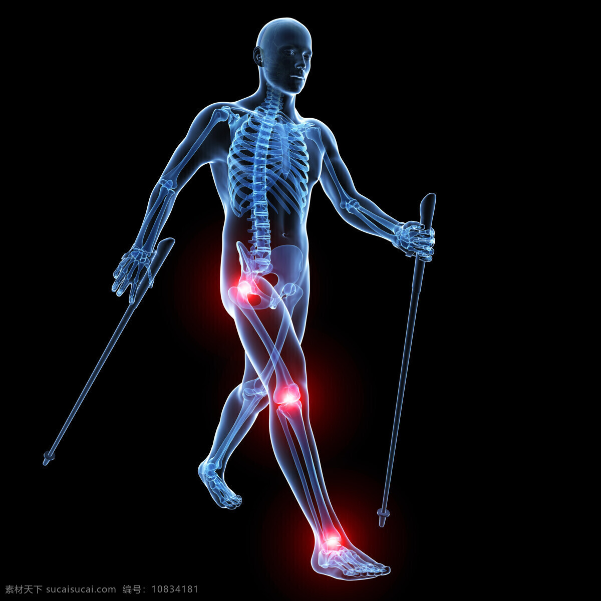 腿 关节痛 腿关节痛 人体器官 人体器官组织 人体医学 医疗护理 现代科技