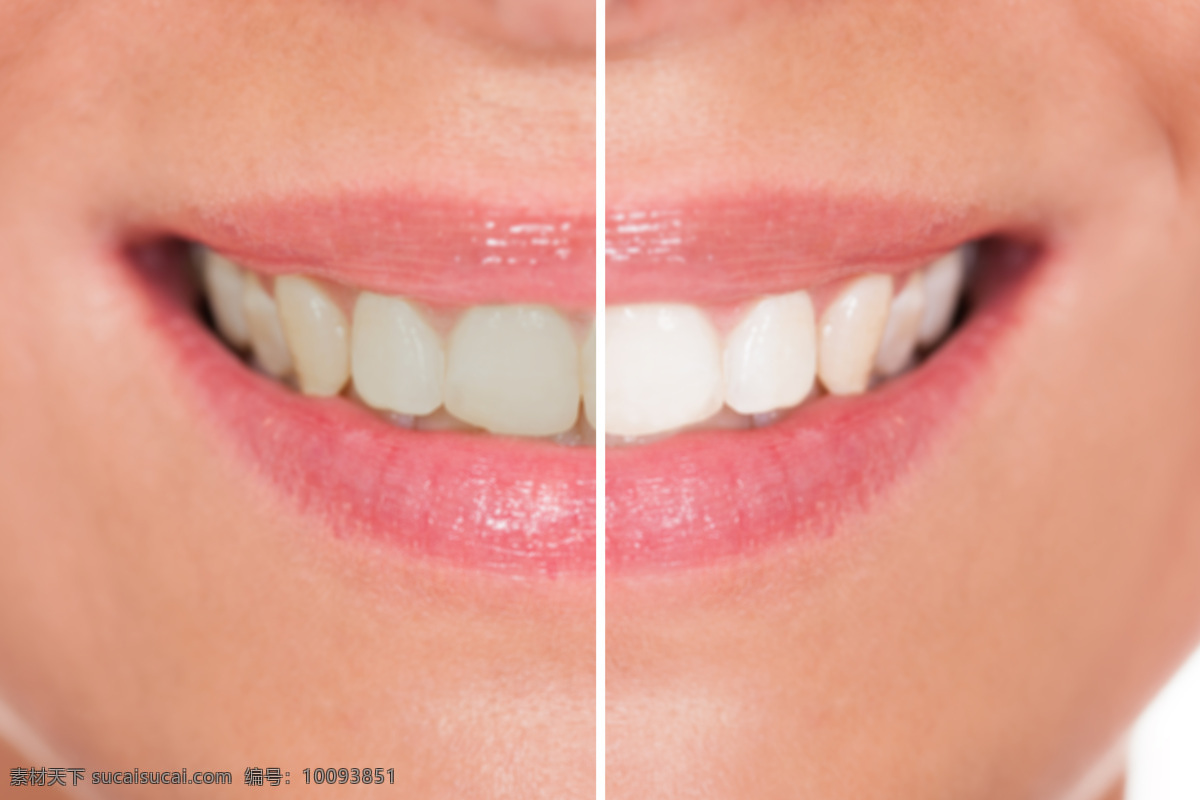 美女 牙 前后 对比 美女牙齿 牙齿保健 牙齿美白 白牙 清洁牙齿 口腔护理 医疗护理 人体器官图 人物图片