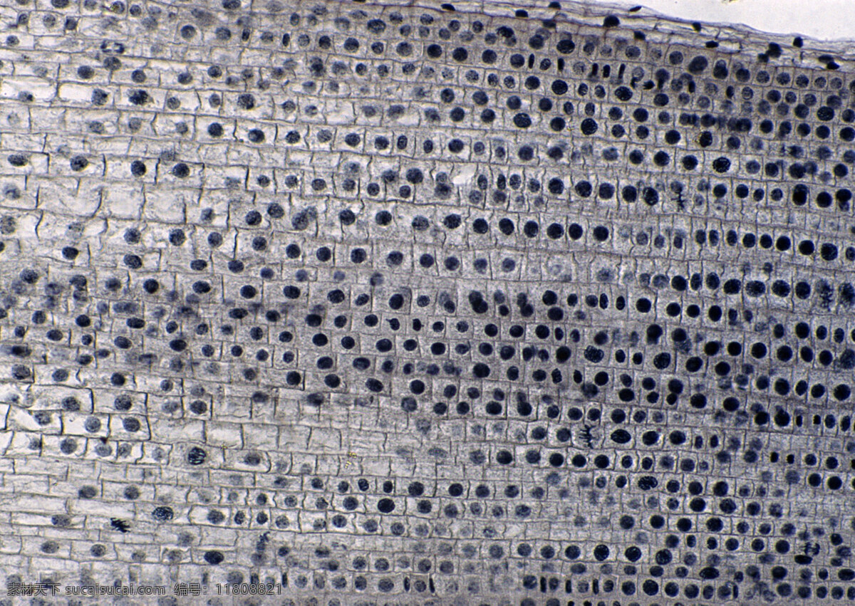黑色斑点细胞 细胞结晶图片 黑色 斑点 微观世界 细胞单元 结晶 灰色