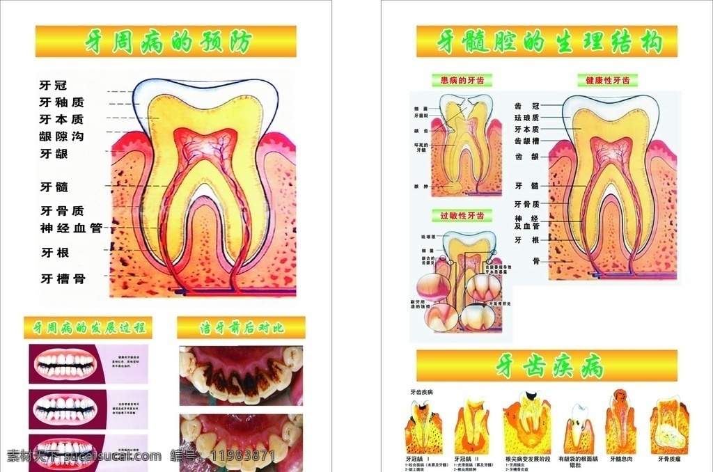 牙周病展板 牙 牙周病的预防 展板 牙齿 牙齿疾病 牙髓腔 展板模板