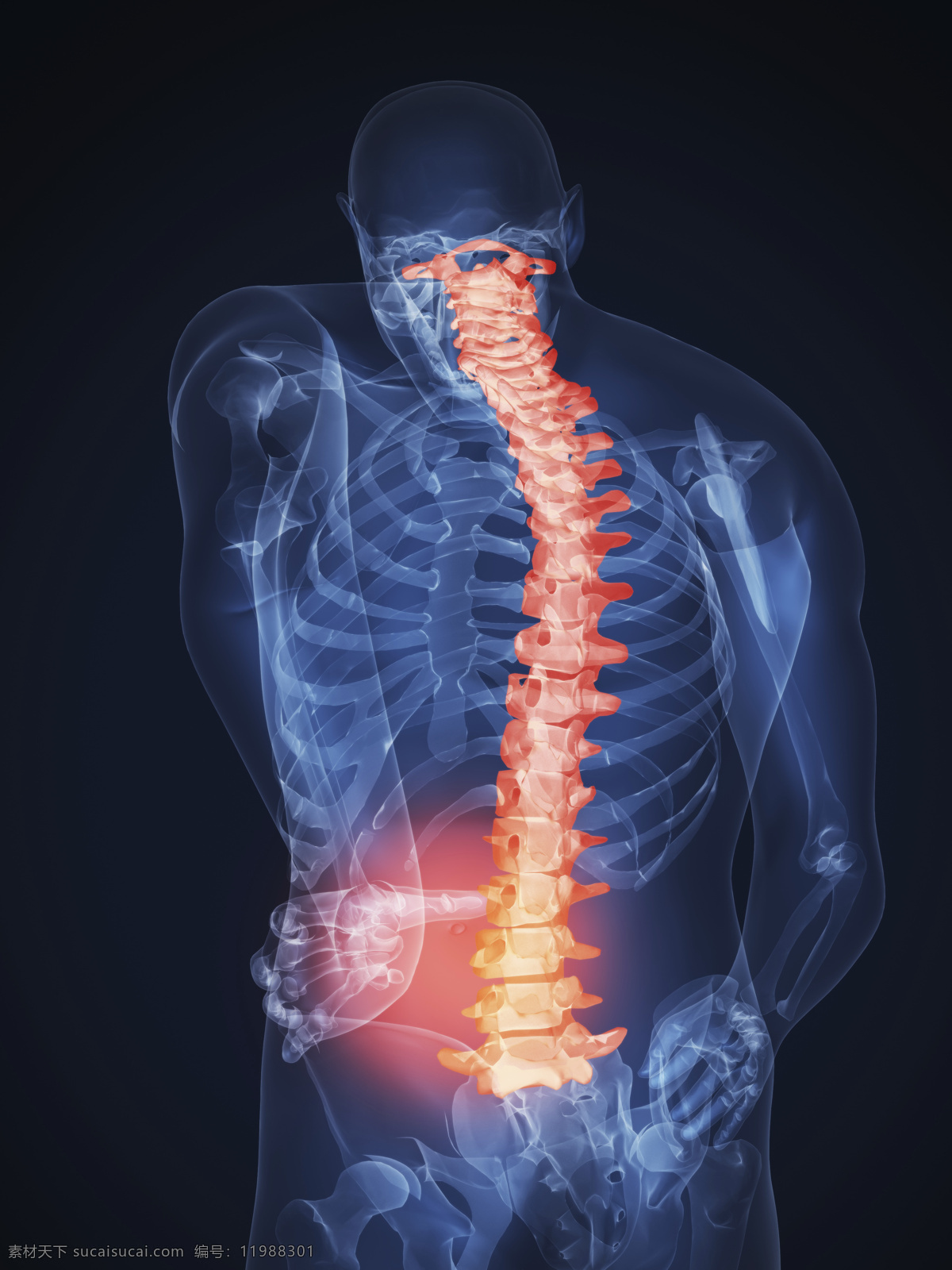 人体 背部 x 光 透视图 x光 图像 医疗主题 医疗护理 现代科技
