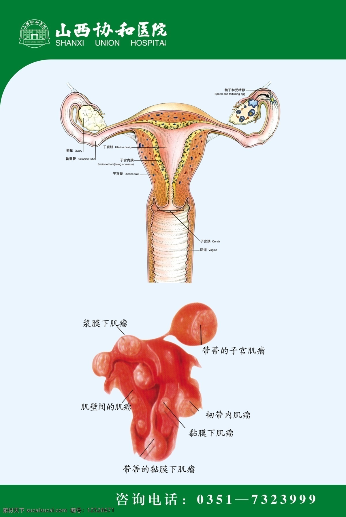 生殖解剖图 生殖 解剖图 输卵管 子宫 妇科 肌瘤 子宫疾病 不孕 医院展板 展板模板 广告设计模板 源文件
