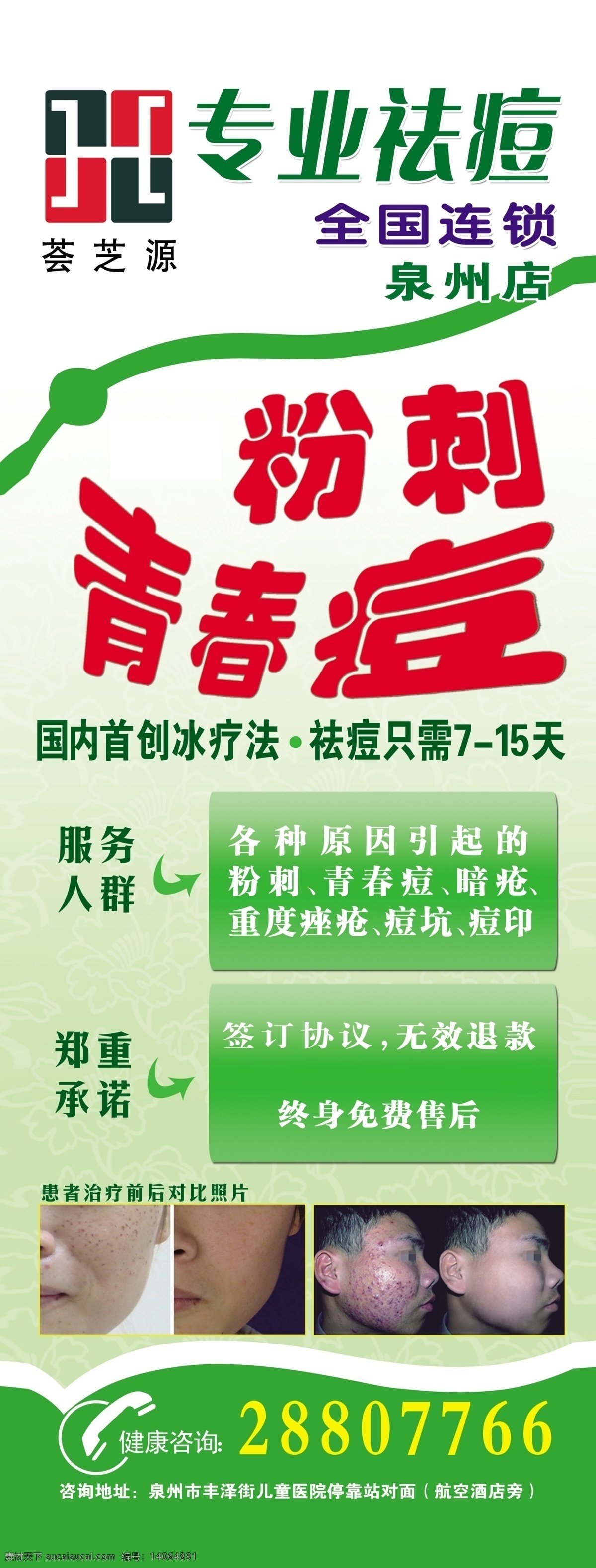 x展架 广告设计模板 绿底 祛痘 人脸 易拉宝 源文件 展板模板 荟 芝 源 模板下载 荟芝源易拉宝 荟芝源 专业祛痘 粉刺 青春痘 服务人群 郑重承诺 治疗前后 易拉宝设计